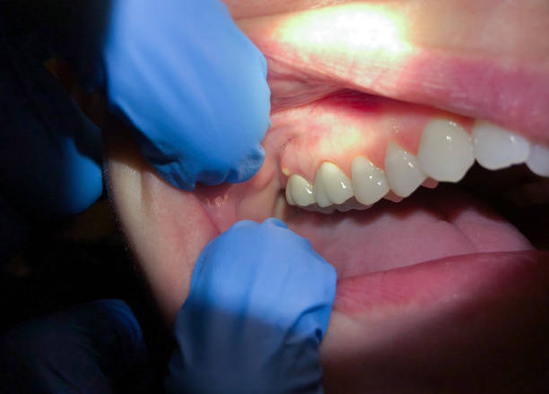 Best Emergency Dentist for Knocked-Out Tooth in Glendale, AZ
